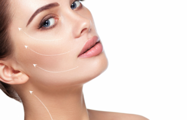 Facelift