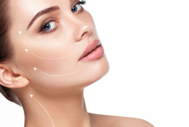 Facelift