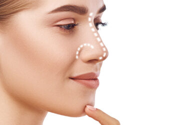 Rhinoplasty
