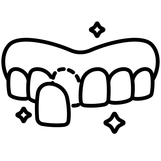 Dental Veneer